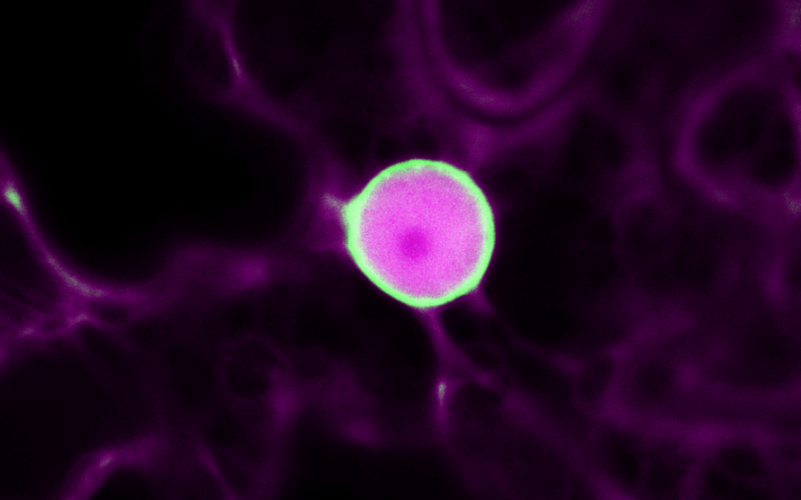 An irregular circle with a green rim and splotchy pink interior on a black background with faint magenta shapes.