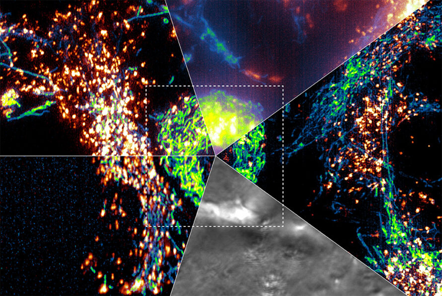 A composite microscopy image divided into five pinwheel-like triangular segments, each showing the same cellular structure using a different imaging technique. Glowing green, blue, orange, and grayscale patterns reveal varied subcellular details, with a dashed square highlighting a central area of interest.